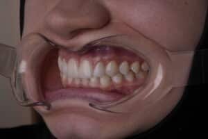 akaclinic