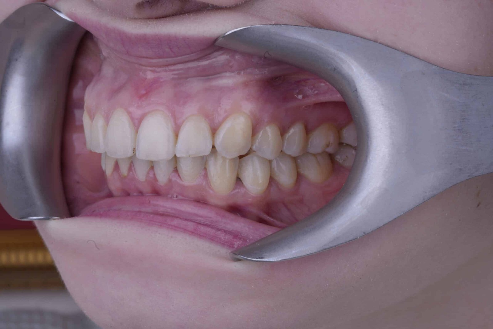 akaclinic